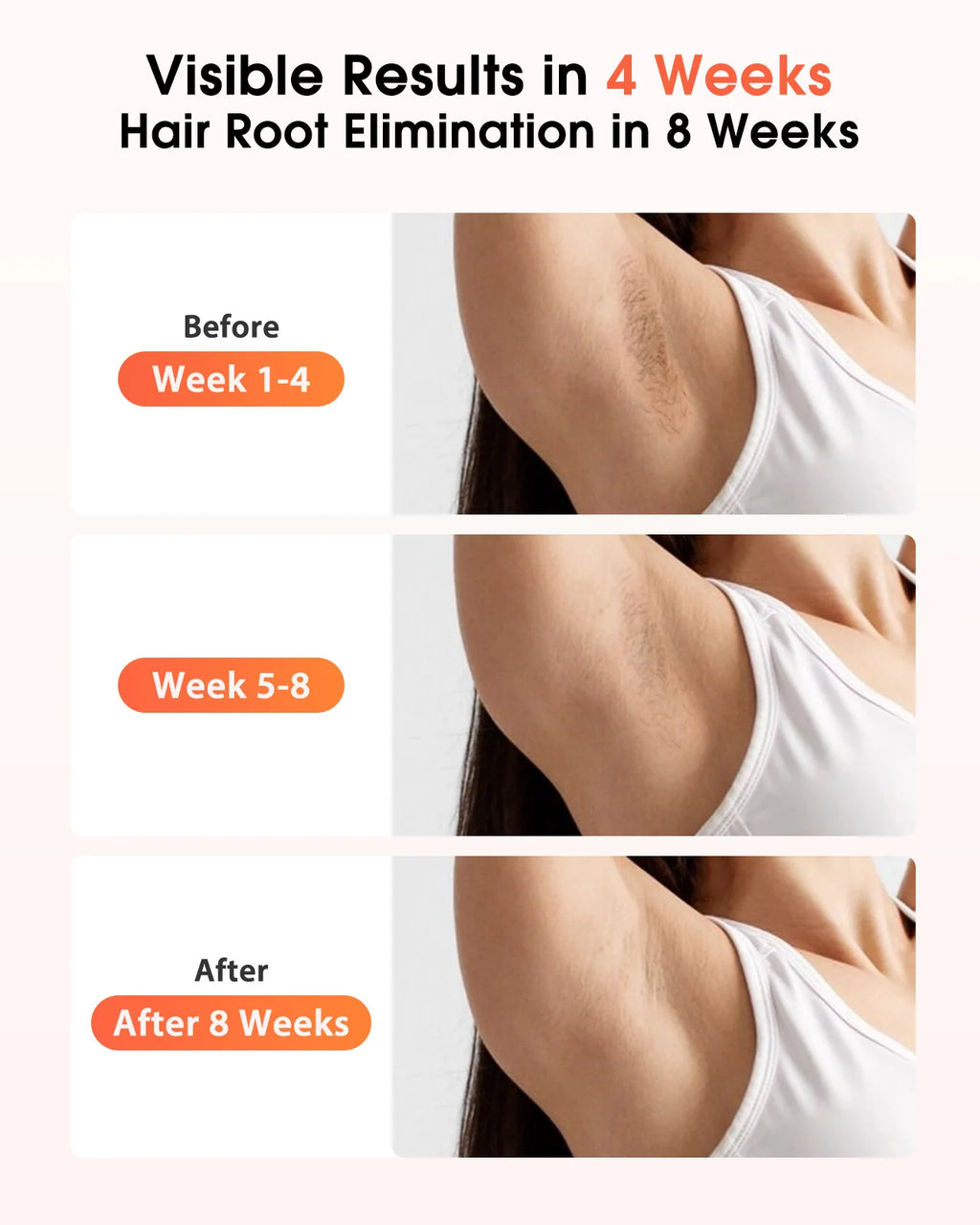 IPL Devices Hair Removal Laser 17J 999900 Light Pulses HR/SC/RA 9 Levels Whole Body Painless Hair Removal Home Use For Men Women